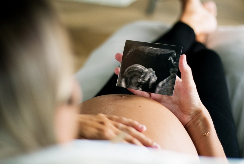 Schwangere Frau liegt auf dem Sofa und schaut sich das Ultraschallbild ihres Kindes an